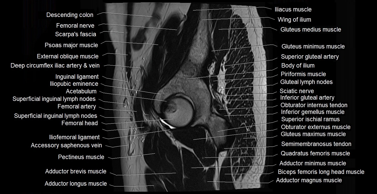 male pelvis sagittal cross sectional anatomy 3T mri image 3.webp